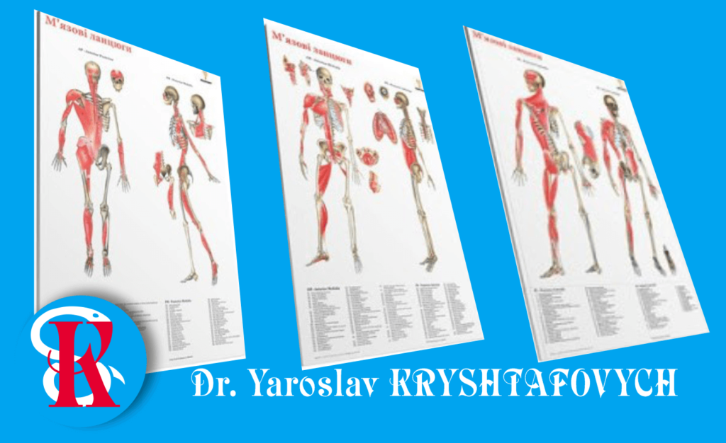 МІОФАСЦІАЛЬНИЙ СИНДРОМ • що слід знати?