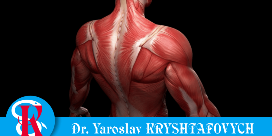 МІОФАСЦІАЛЬНИЙ СИНДРОМ • що слід знати?